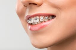 Happy patient