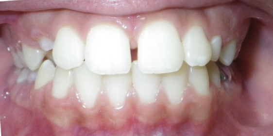 Before Dental Treatment